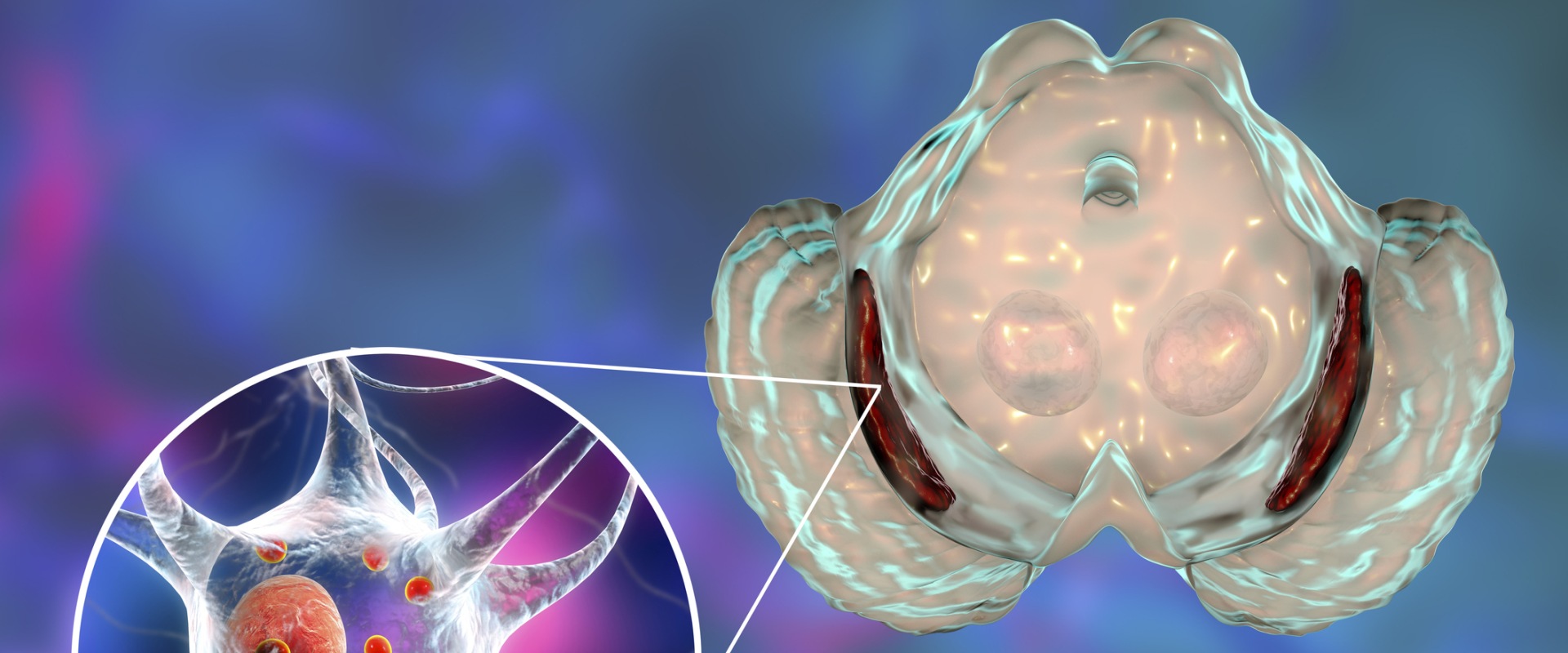 Levodopa for Parkinson's Disease: A Comprehensive Overview