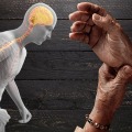 Understanding Parkinson's Disease: The Importance of Early Diagnosis